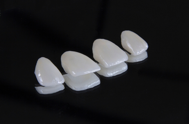 Estética Dental Carillas