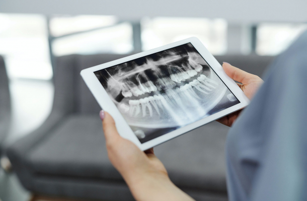 Endodoncia