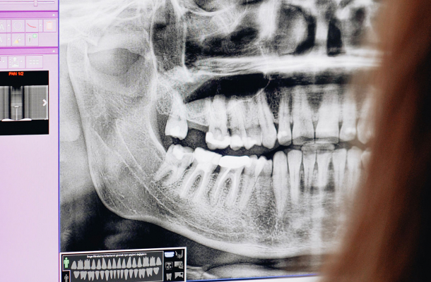 Radiología Digital