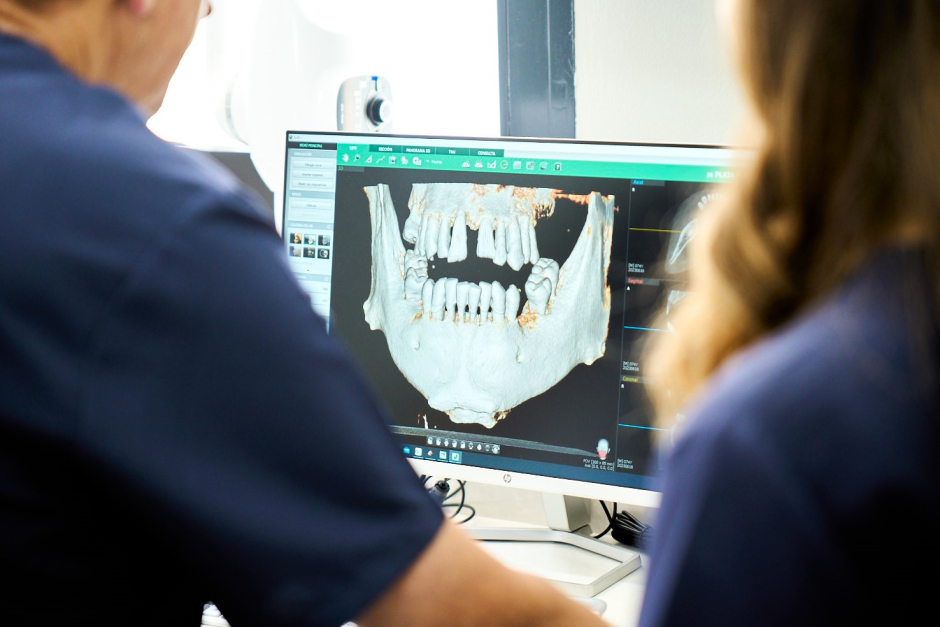 El fenómeno Turkey Teeth, y la importancia de acudir a una clínica dental de confianza